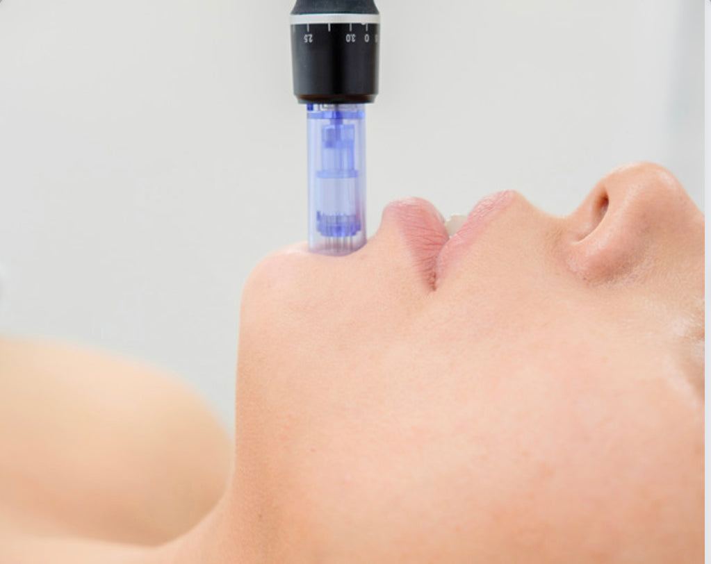 Microneedling